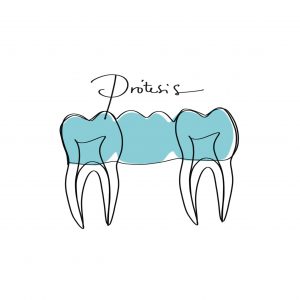 Prostodoncia Prótesis Dental e Implantoprótesis en Oviedo Clínica Rodríguez-Fernanz Dr. Samuel Rodriguez-López en Oviedo Posada Herrera 4 3-D Teléfono 985 21 55 40